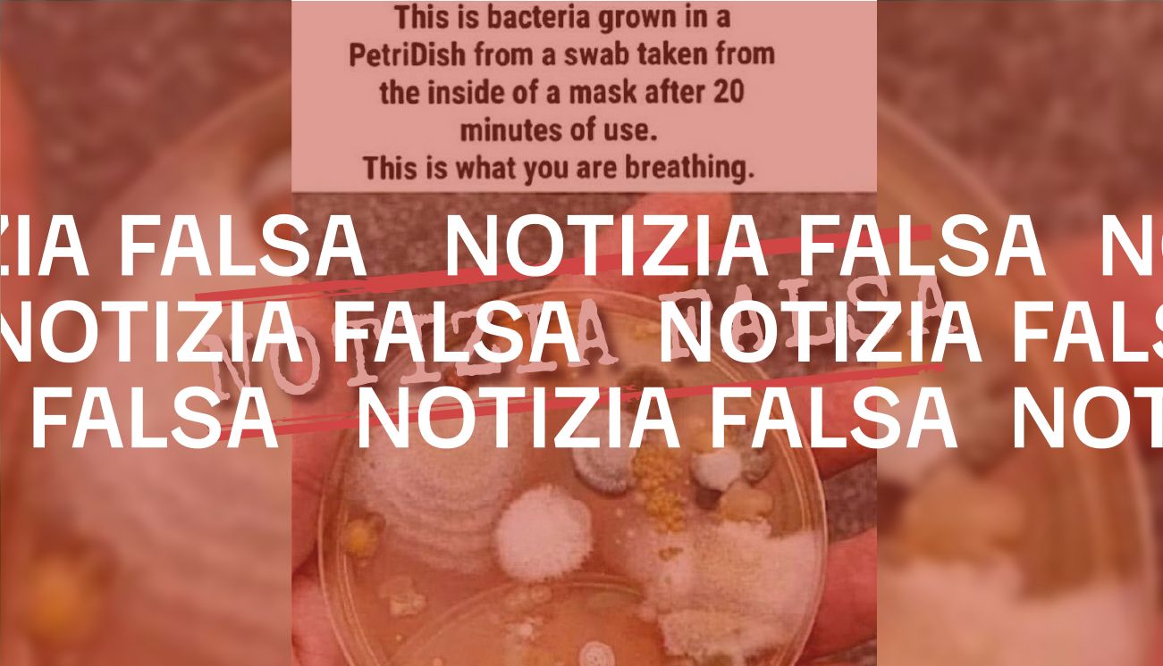 Questi non sono i batteri di «una mascherina dopo 20 minuti di utilizzo»